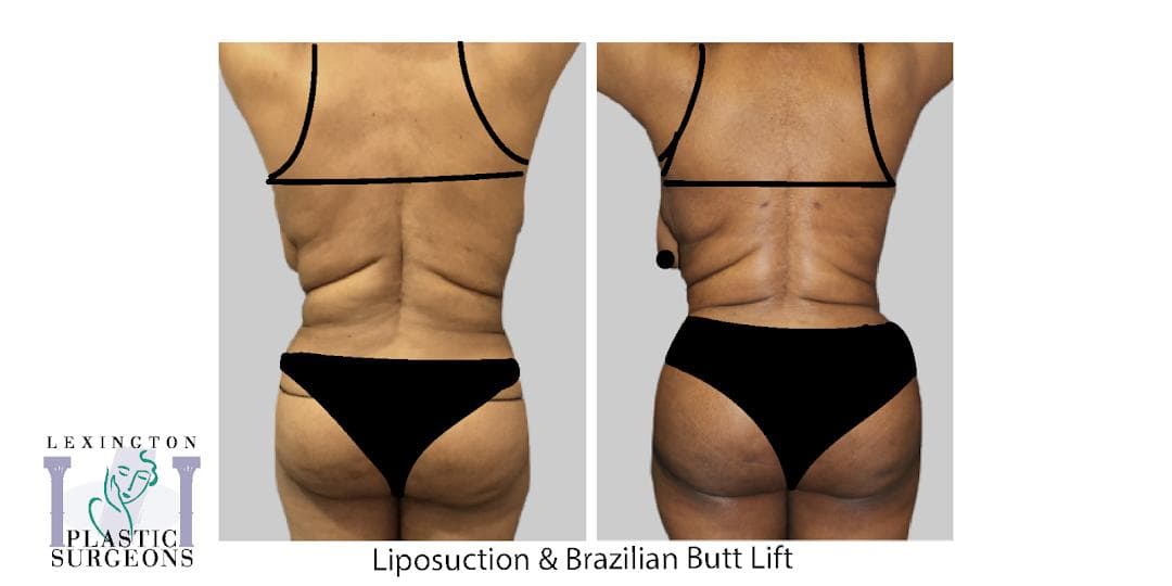 Lexington Plastic Surgeons photo 1